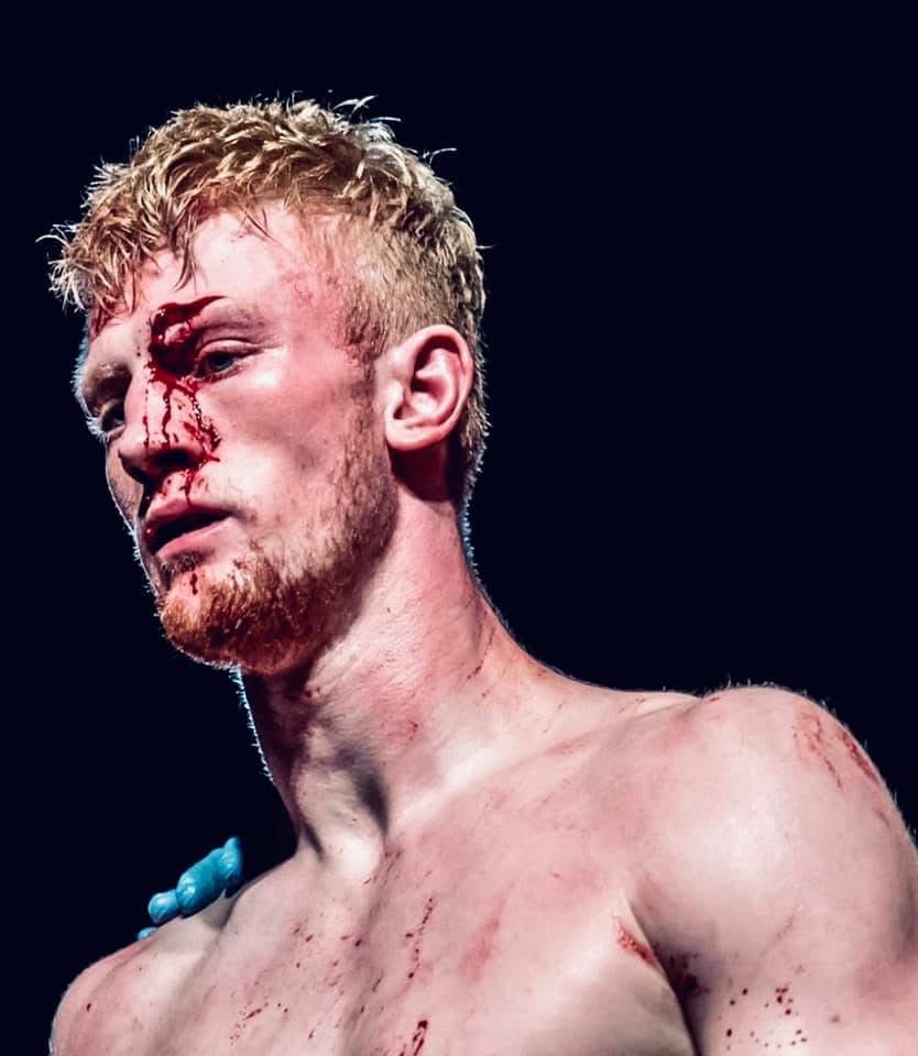 Alex MacGregor bloodied and composed after a hard Muay Thai fight